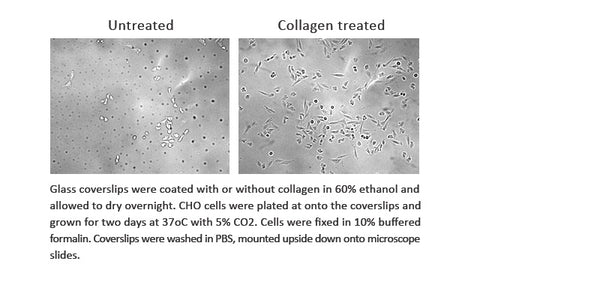 Collagenase Type I Solution 0.25％ in PBS with 20％ FBS, 20ml